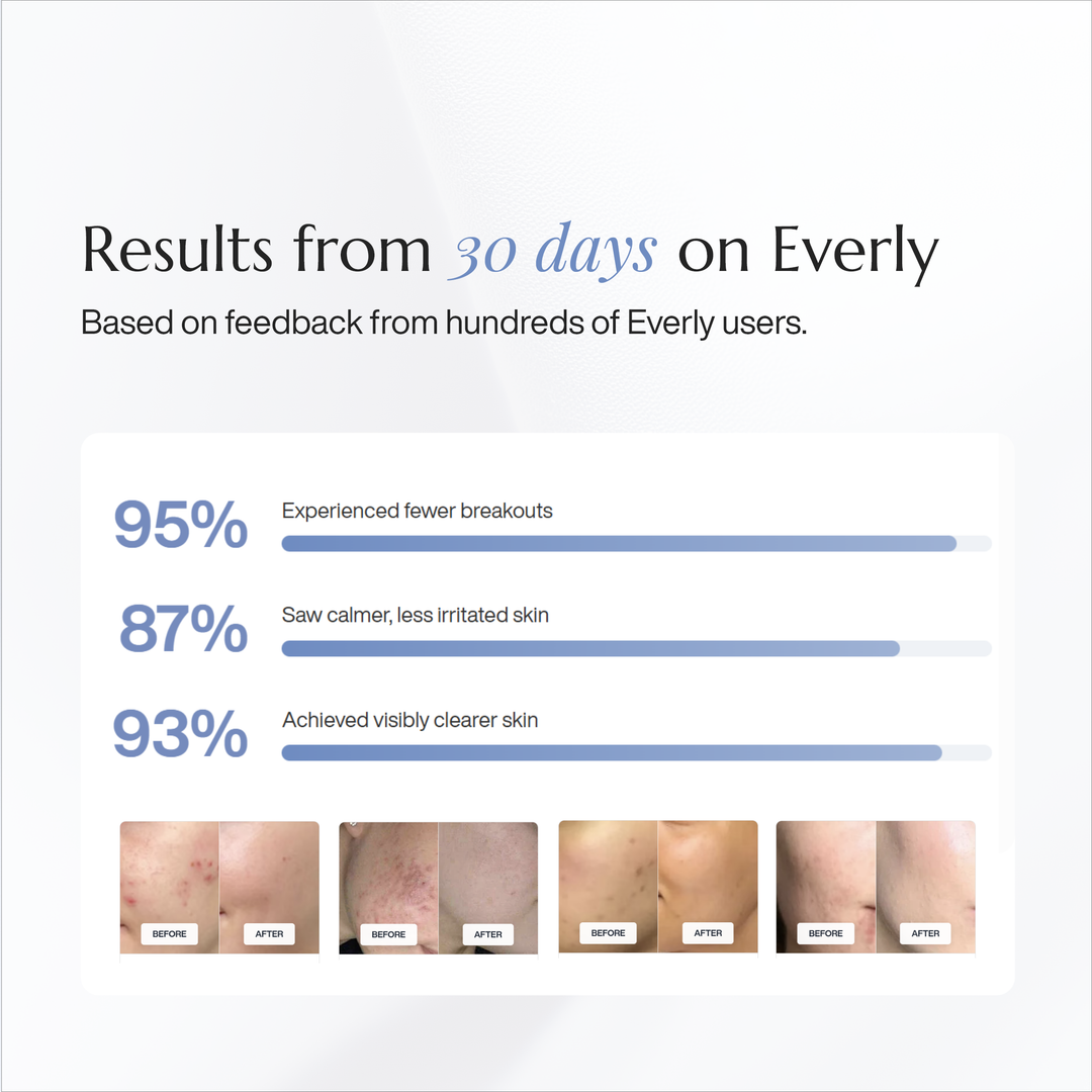 Everly lifestyle